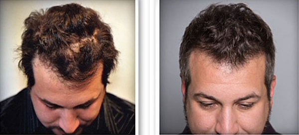 Джой Фэйтон