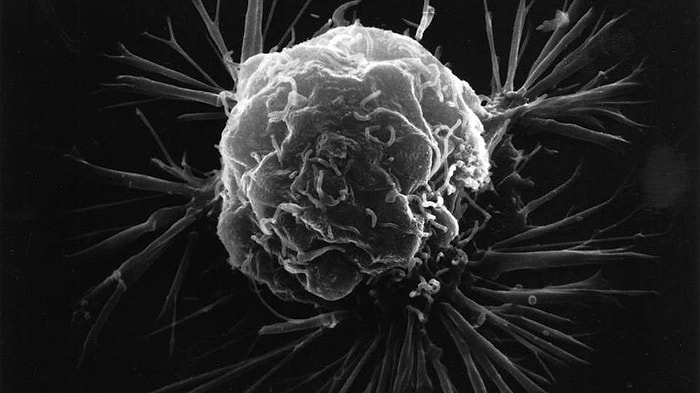 Kanserli Bir Tümörün Oluşma Anı İlk Kez Görüntülendi