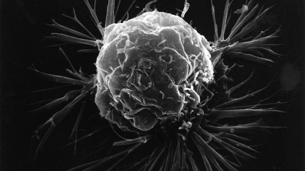 Kanserli Bir Tümörün Oluşma Anı İlk Kez Görüntülendi