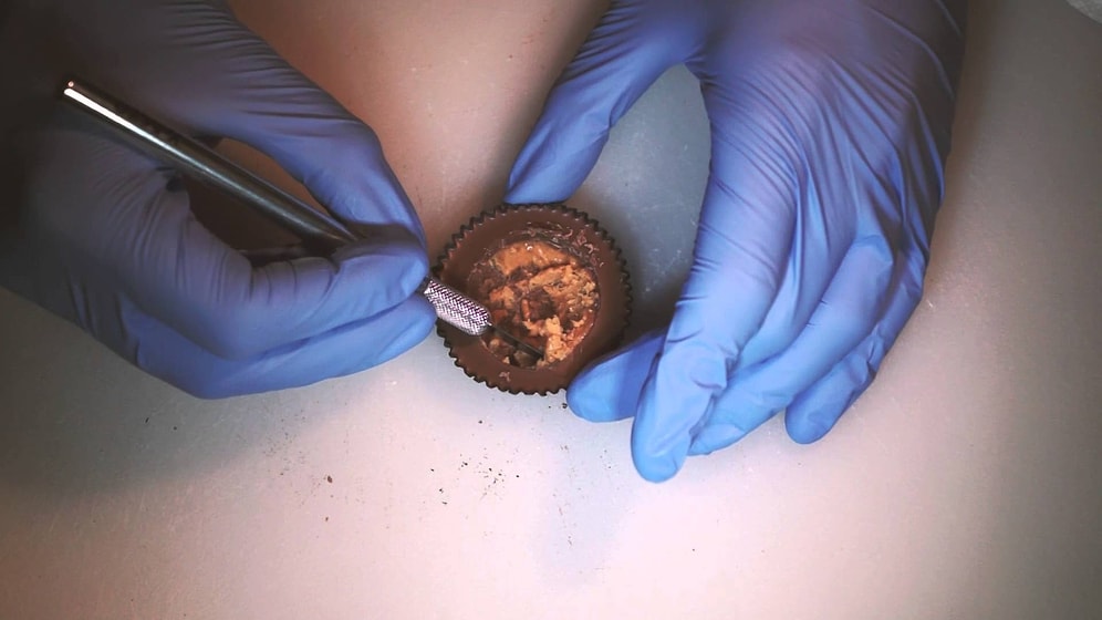 Çünkü Neden Yapmasın: Ameliyat Konusundaki Marifetlerini Püskevit Üzerinde Gösteren Adam