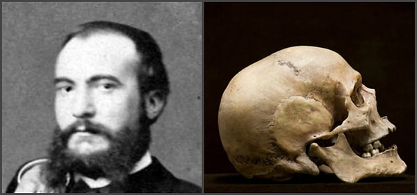 6. Синдром Котара