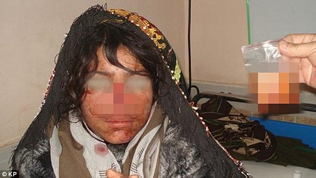 Bir gün ise gözünü açtığında hastanedeydi, başucunda annesi ve babası ile birlikte