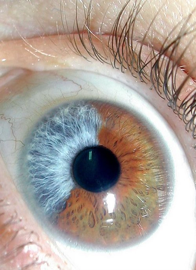 'Peki Bunlar Renkli Gözse Bizimki Ne Oluyor?' Diye Sordurtan 35 Renkli Göz