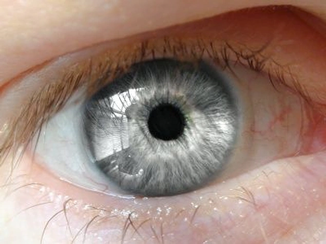'Peki Bunlar Renkli Gözse Bizimki Ne Oluyor?' Diye Sordurtan 35 Renkli Göz