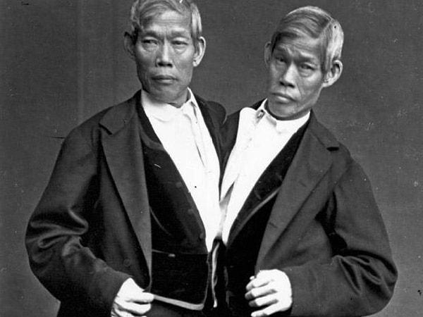 13. Chang ve Eng - Siyam İkizleri