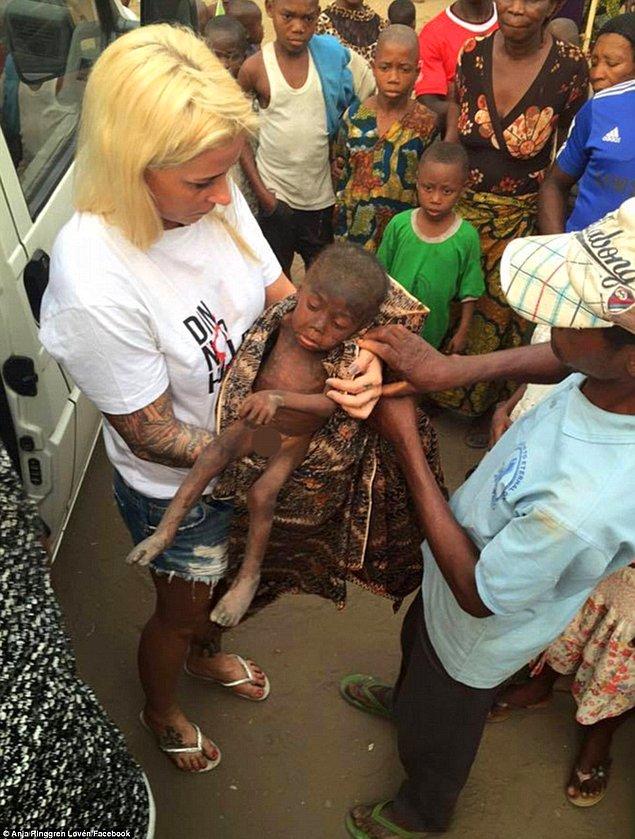 Yardım ekibi, açlıkla boğuşan çocuğu yaralanmış ve solucanlar tarafından her yeri kemirilmiş hâlde buldu.