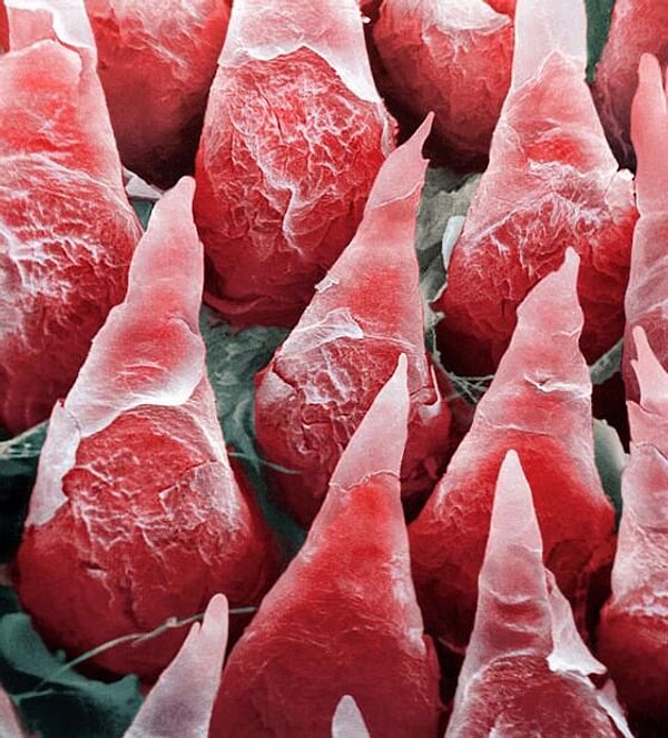 7. Человеческий язык под микроскопом