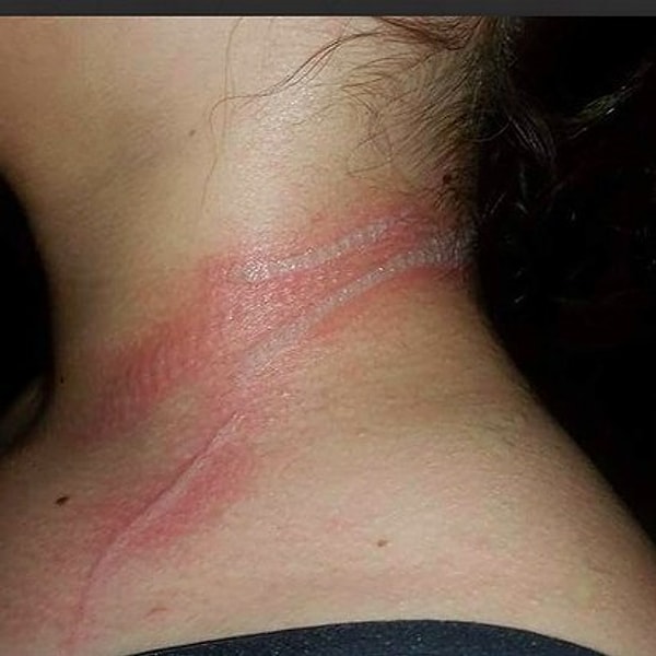 1. Родительница из Иллинойса высказывается по поводу произошедшего с ее 13-летней дочерью: девушка получила ожог второй степени, потому что использовала свой мобильный телефон, пока он был на зарядке.