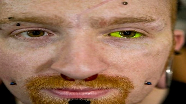 Göz Dövmesi- Kanada