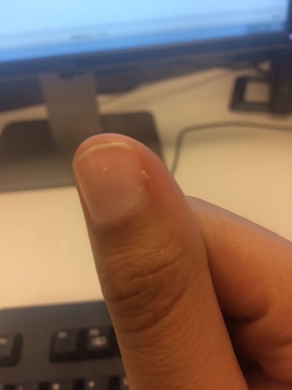 16. Одно слово: заусенцы