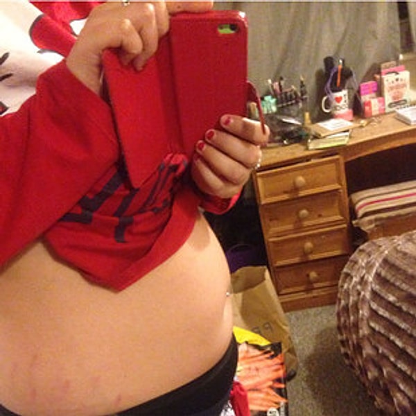 5. Пэнкхерст сообщила, что в больнице ее кормили через трубочку. Она сказала: «Врачи спросили, когда я в последний раз ходила в туалет, но я не смогла вспомнить. Я так беспокоилась об экзаменах и о том, чтобы хорошо все сдать, что даже не обратила на это внимание».