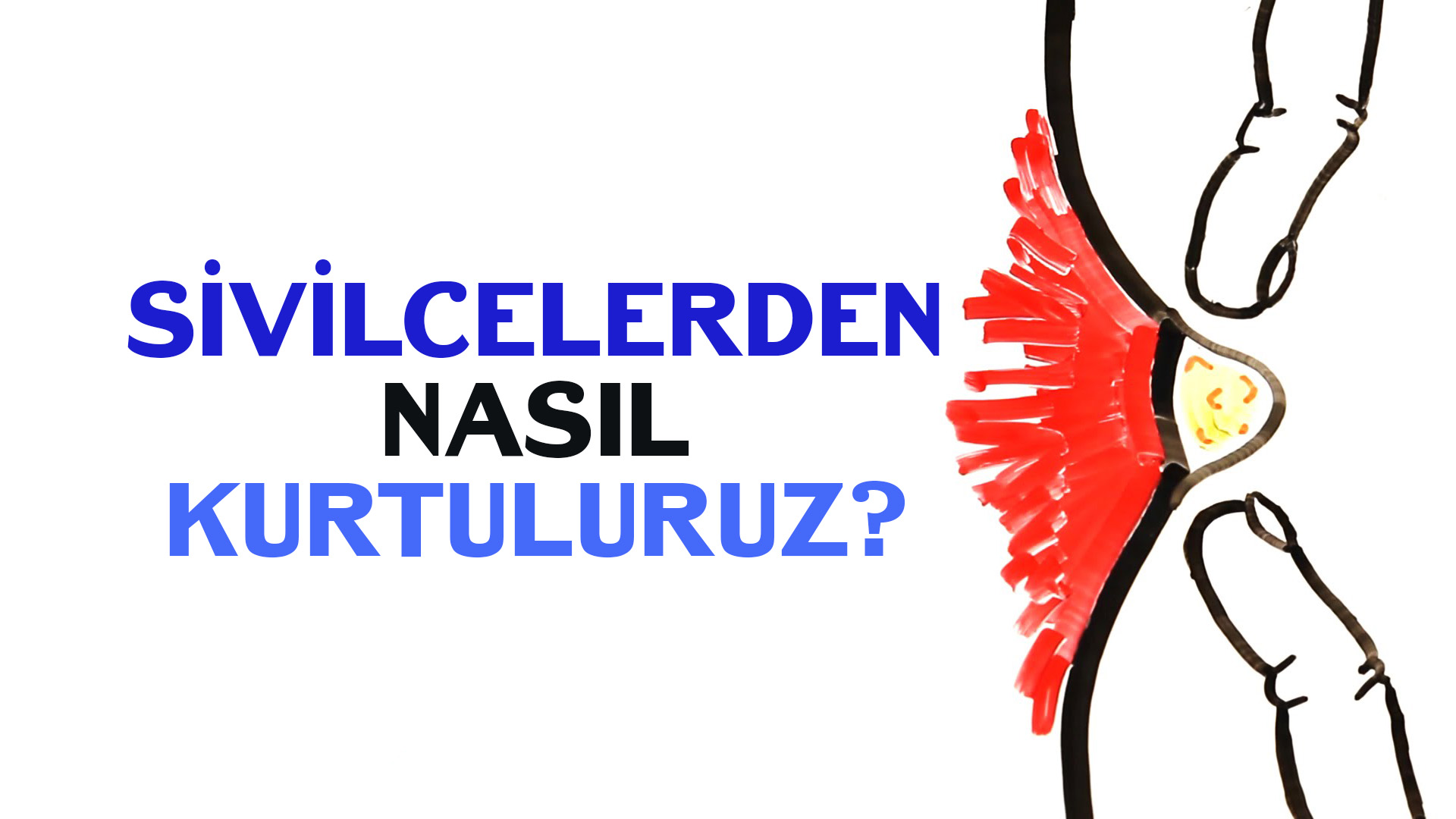 Sivilceler Neden Ortaya Çıkarlar Ve Onlardan Nasıl Kurtuluruz? - Onedio.com