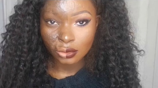 Магия макияжа: Девушка мастерски скрывает ожоги на лице после аварии