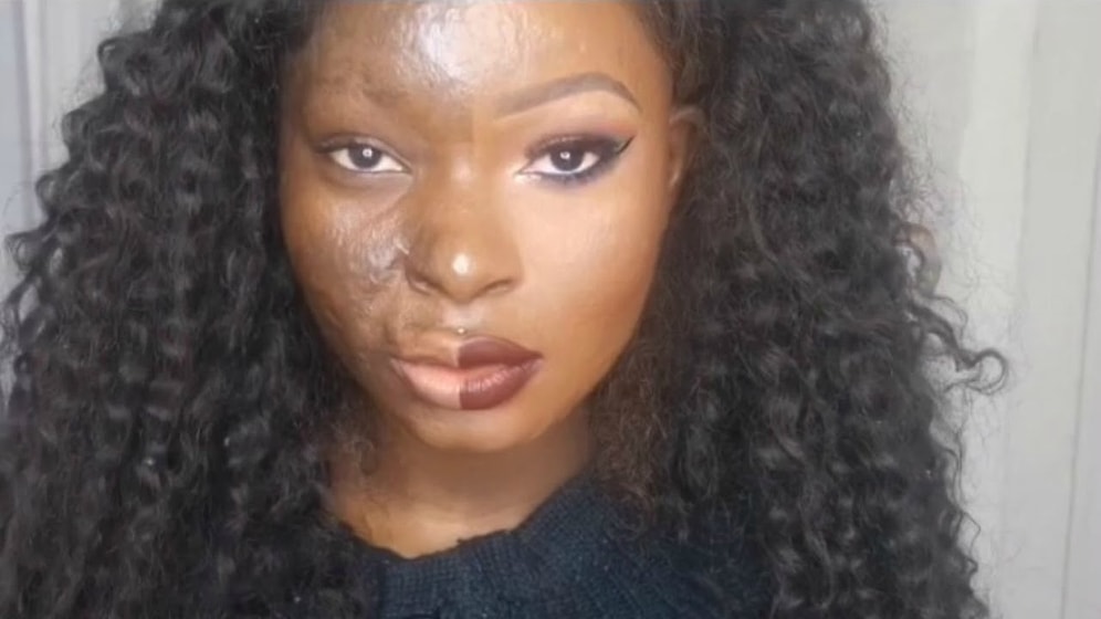 Магия макияжа: Девушка мастерски скрывает ожоги на лице после аварии