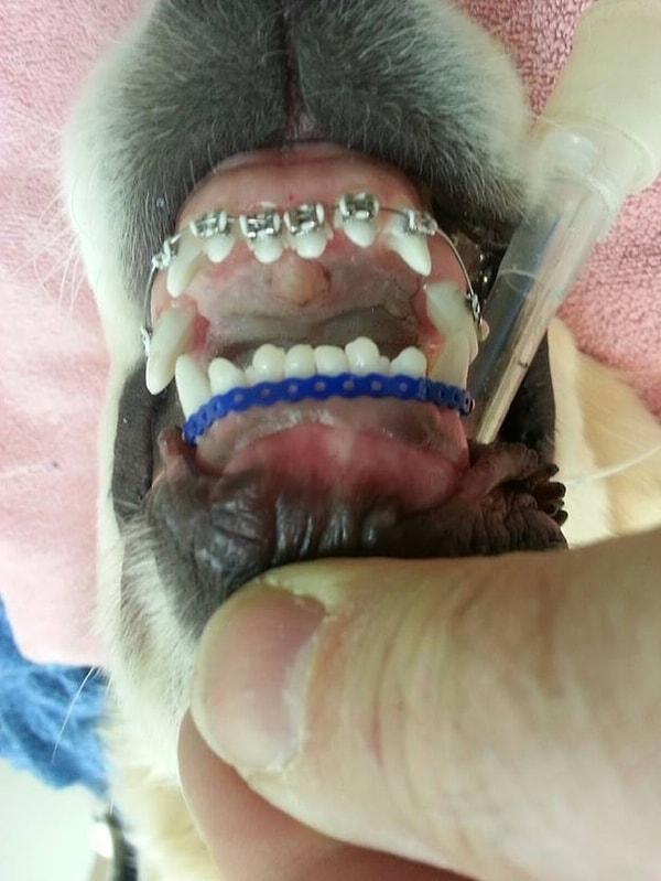 9. Küçük bir operasyonla Wesley'e diş telleri takıldı.