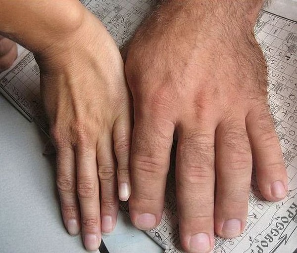 3. Пальцы-сосиски"