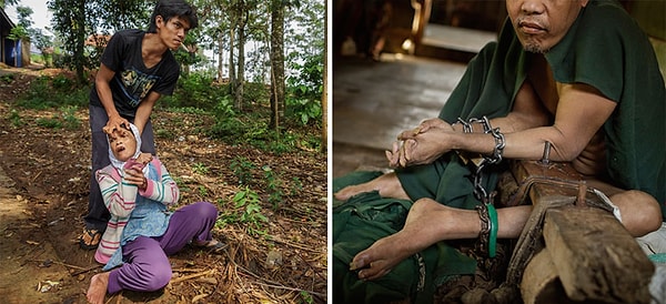 9. Весь персонал лечебницы проходит обязательное обучение, как нужно действовать в чрезвычайных ситуациях. Сайпудин (справа) признан опасным, его нога и рука прикованы к дереву уже 9 лет, его мышцы давно атрофировались.