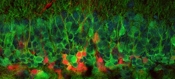 Canlı Bir Beyinde Oluşan Yeni Nöronların İlk Görüntüsü