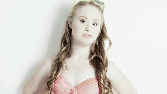 Мечты сбываются: модель с синдромом Дауна примерила подвенечное платье