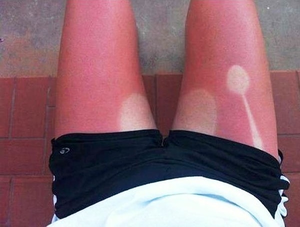 7. Загорела! ☀