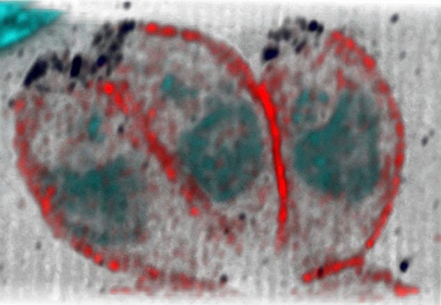 19. Toksoplazma gondii