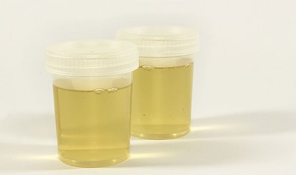 3. Ученые выяснили, как заряжать телефон с помощью мочи.