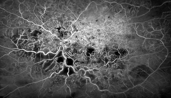 12. Кровеносные сосуды глаза