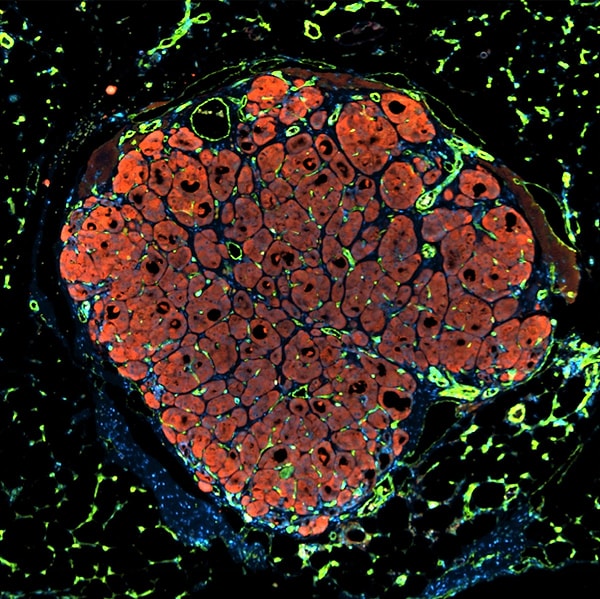 14. Ткань человеческой печени