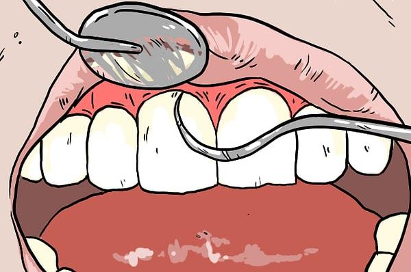 5. Dişçiye gittiğinde diş taşların temizlenirken çıkan şu çirkin sivri aletin çıkardığı ses ve dişlerinde yarattığı o eşsiz his hakkında neler söylemek istersin?