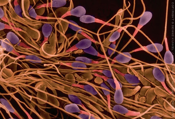 24. За всю свою жизнь мужчина эякулирует около 17-ти литров семенной жидкости, что составляет приблизительно 500 миллиардов сперматозоидов.