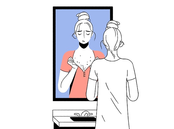 11. Когда ты думаешь, что ты уже взрослая и пубертатный период давно прошел, и на твоей груди появляется миллиард прыщиков