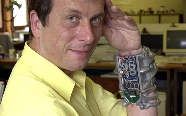 6. İngiliz profesör Kevin Warwick, sibernetik bir implanta sahip.