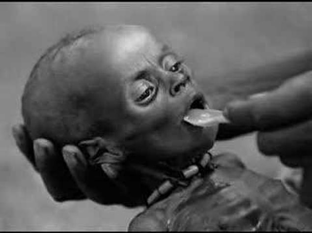 9. Every year, more than 11 million children die because of preventable diseases.