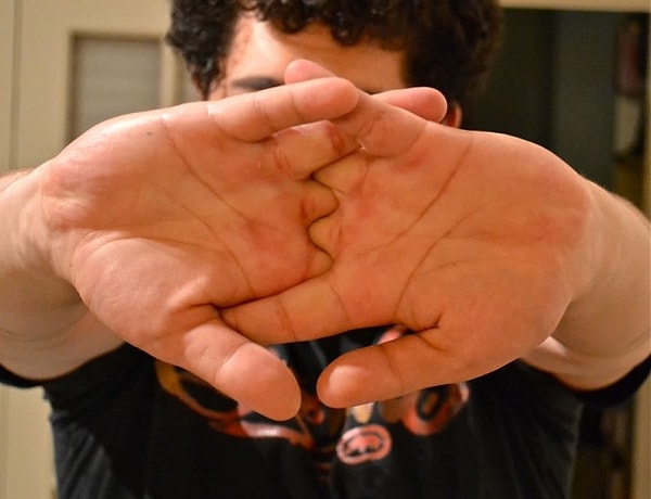 13. Щелканье суставами приводит к артриту