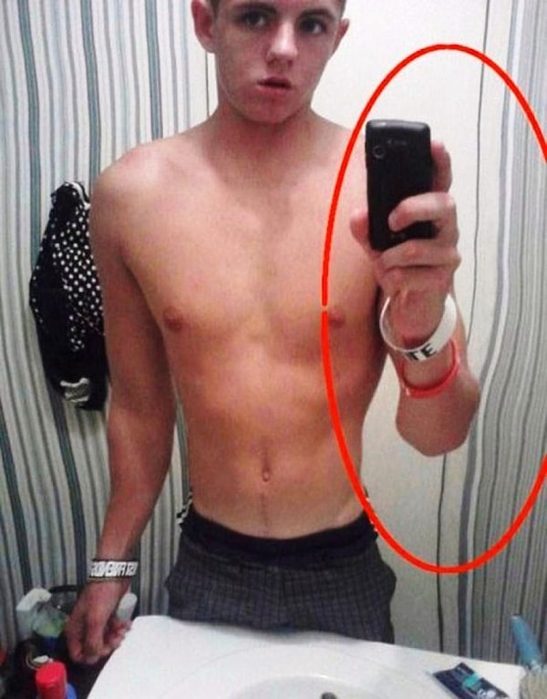 3. Что с рукой? 😣