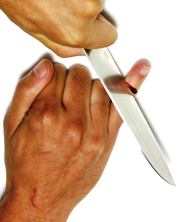 10. Члены якудза, нанёсшие оскорбление лидеру группировки, ампутируют себе пальцы, чтобы заслужить прощение. Также они могут пожертвовать своим мизинцем, чтобы спасти жизнь младшему члену группировки, которому грозит смерть за оскорбление старшего.