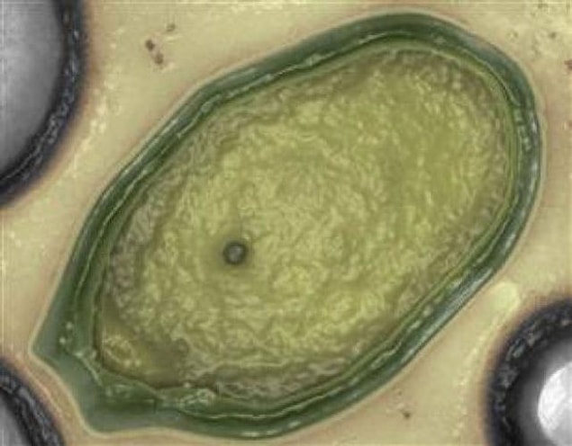 16. The world’s largest virus, named Pandora, was found off the coast of Australia, it also holds about 93% unidentified genetics.