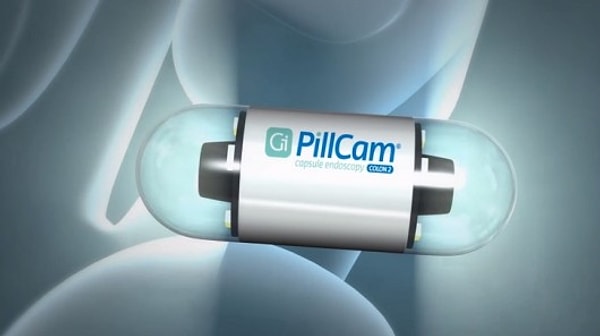 18. Вы можете проглотить маленькую камеру-капсулу вместо колоноскопии