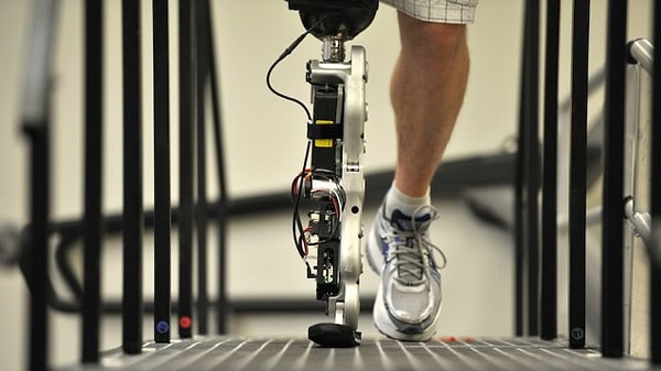 25. Бионическая нога