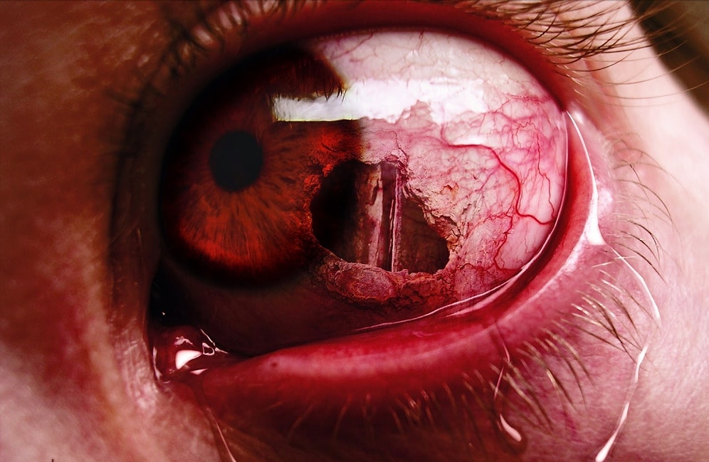 Ölüme Bir Adım Mesafede Olduğunuzu Düşünün: Savaşır mısınız Yoksa Sıvışır mısınız?