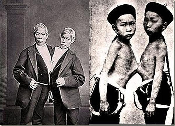 9. Dünyaya "siyam ikizleri" terimini kazandıran Chang ve Eng, 1874'ün Ocak ayında, 63 yıldır paylaşmakta oldukları yataklarında yaşamlarını yitirdiler.