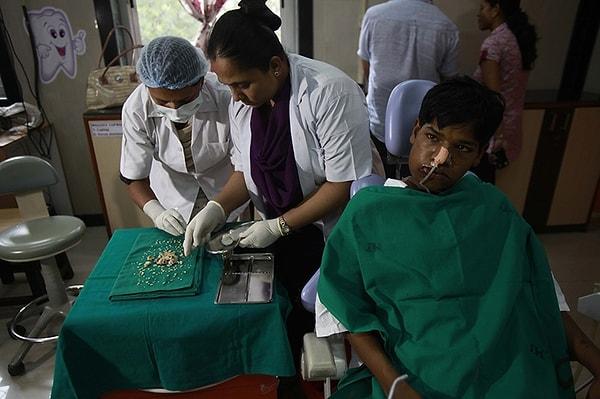 Bu hastalıkla ilgili en ilginç olay, Hiperdonti’den mustarip olan Hindistanlı bir gencin ağzından 6 saat süren bir operasyonla 232 küçük dişin alınması oldu.