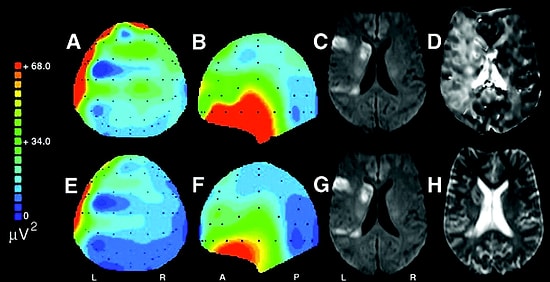 Beyni İncelenen Epilepsi Hastasından Beklenmedik Tepki: Tanrıyı Gördüm!