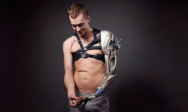 Şuan 26 yaşında olan James, kullandığı biyonik kol ile kısmen Cyborg'a benziyor.