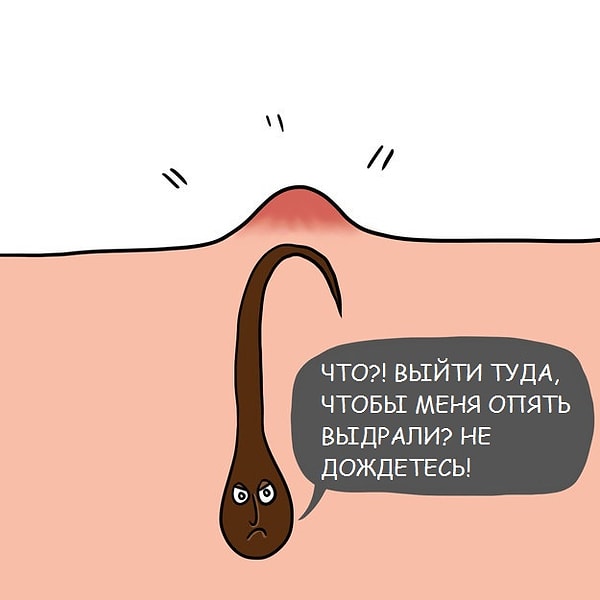 6. Отрастить кустики - единственный способ избавиться от вросших волос