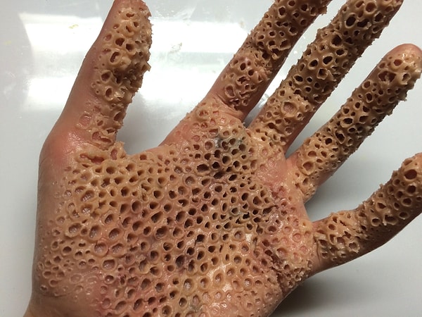 1. Если вы трипофоб, то сам вид пористых отверстий или даже мысль о них вызывает у вас отрицательные эмоции.