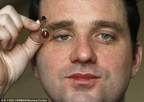 4. Камера в глазу