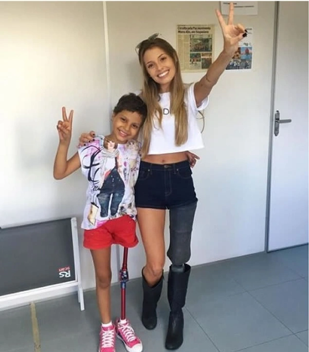 Protez Bacağını Gururla Sergileyerek Engellere Meydan Okuyan Modelle Tanışın!