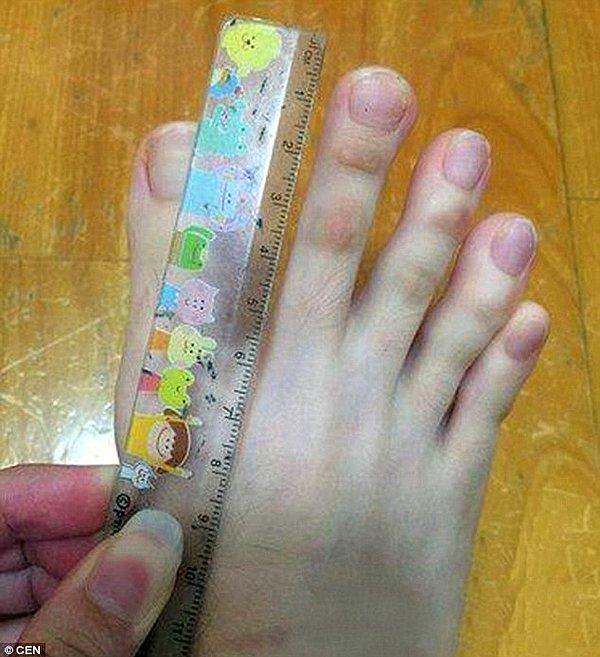 Boyu 150cm olan Tayvanlı üniversite öğrencisi kadının en uzun olan ikinci parmağı ise 5 cm uzunluğunda.
