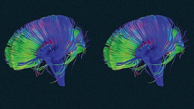 Beyninizin İçinde "Sil" Komutlu Bir Tuş Olduğunu Biliyor Muydunuz?
